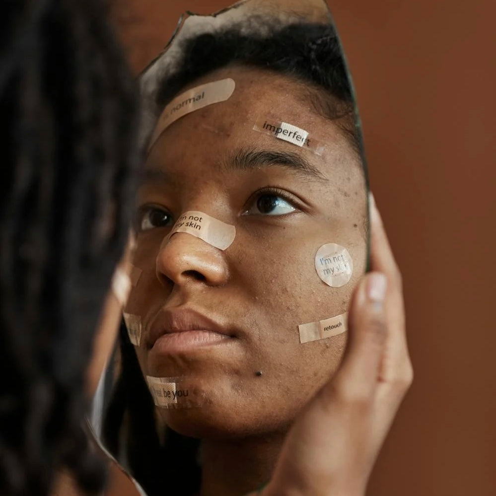Breaking Out? 5 Skincare Mistakes You Might Be Making
