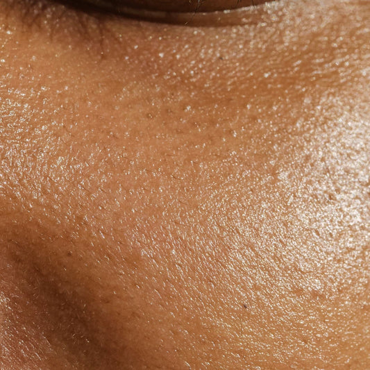 The Truth About Pores: You Can’t Shrink Them, But…