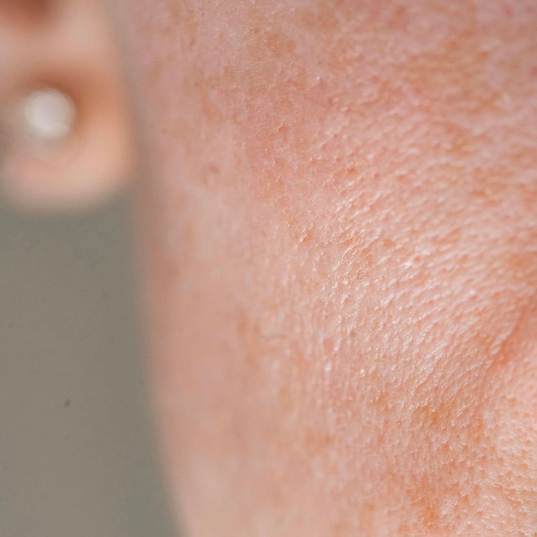 Can Retinol Dry Out Your Skin? Here’s How to Use It Without Irritation