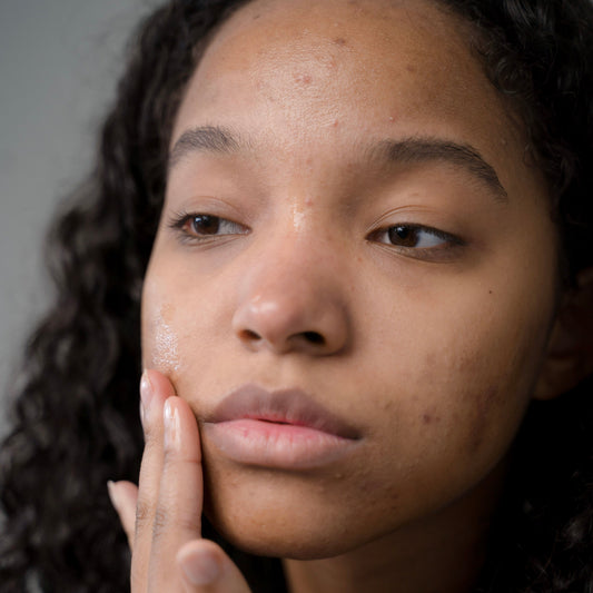 Retinol Purging vs Breakouts: How to Tell the Difference