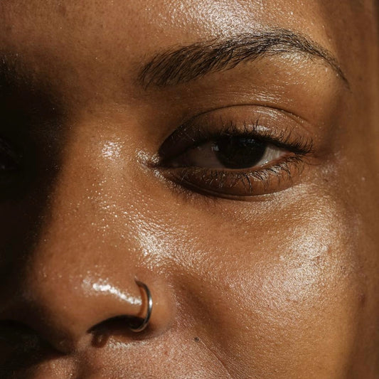 How to Soothe Sensitive Skin Naturally
