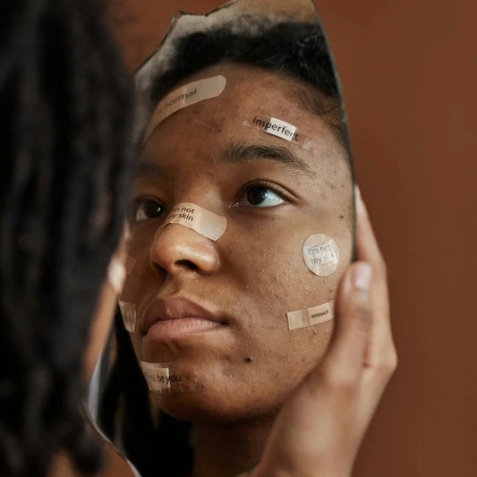 Breaking Out? 5 Skincare Mistakes You Might Be Making